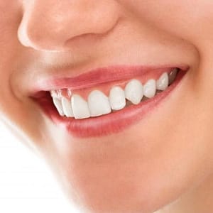 Endodontie (Wurzelkanalbehandlung) 